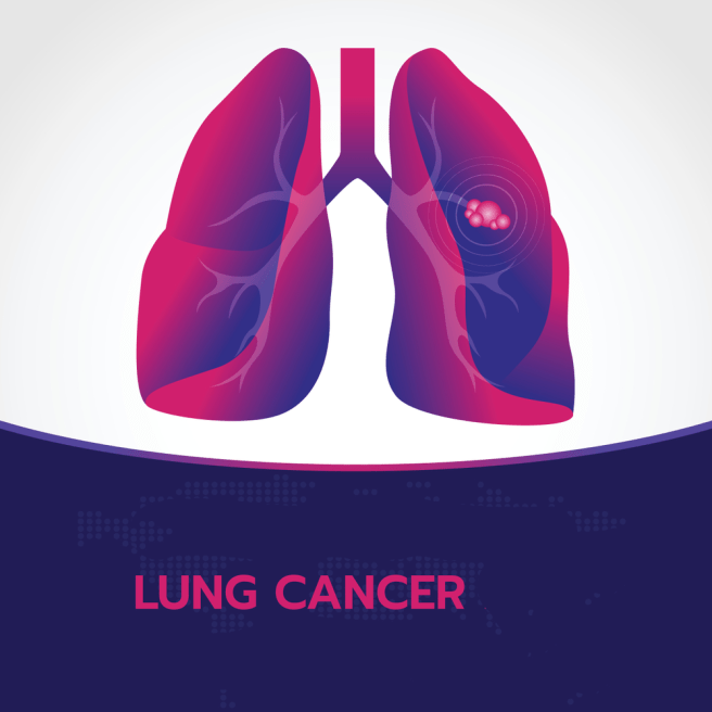 Lungs Cancer