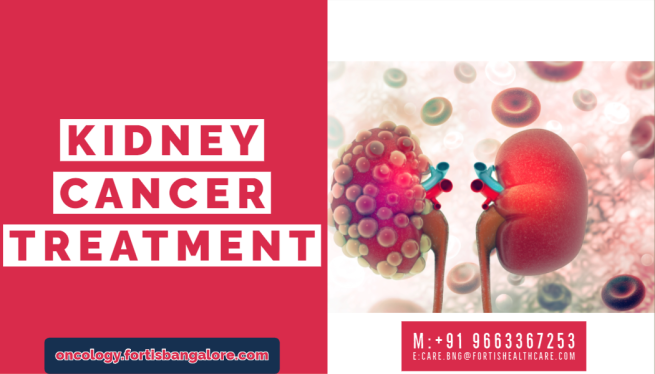 Kidney Cancer Treatment