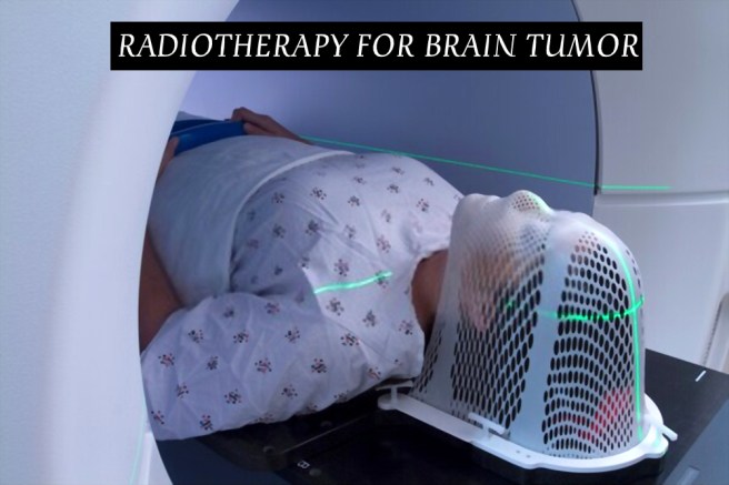 Radiotherapy for brain tumor patients